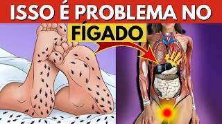 GORDURA NO FÍGADO: os ALIMENTOS que ajudam a REVERTER a gordura hepática