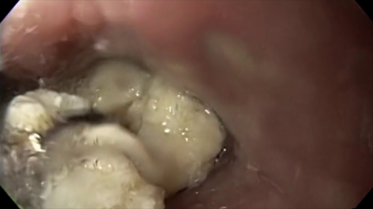 Adriana Fabiola Romano Munive-28