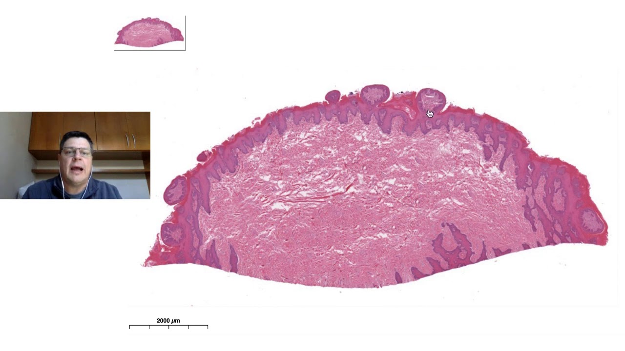 Histologia da língua