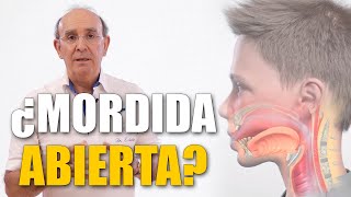 Cómo colocar la lengua al tragar saliva | Deglución atípica