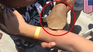 Shark attack: Nurse shark bites Florida woman on the arm and refuses to let go - TomoNews