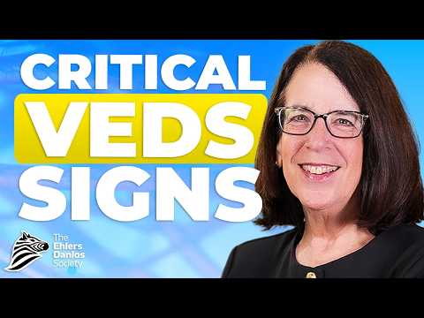 A Doctor’s Guide to Vascular EDS: Recognizing the Signs for Early Diagnosis