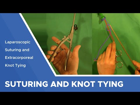 Laparoscopic Suturing and Extracorporeal Knot Tying