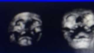 French Style Furs - Is Exotic Bait (Album Teaser #2)