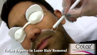 preview picture of video 'Laser Hair Removal for Men at CoLaz Southall'