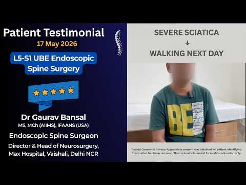 Severe Sciatica Relief After Endoscopic Spine Surgery | Patient Recovery Story