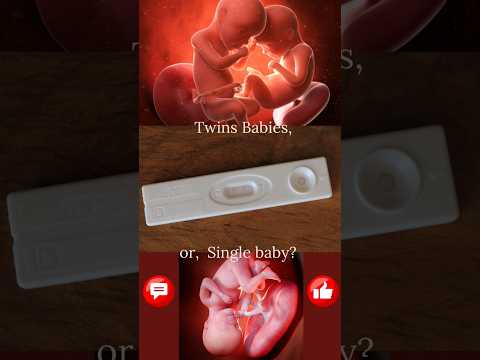 Single or Twin Babies? Which one do you Desire? #shorts #pt #twins #pregnancy