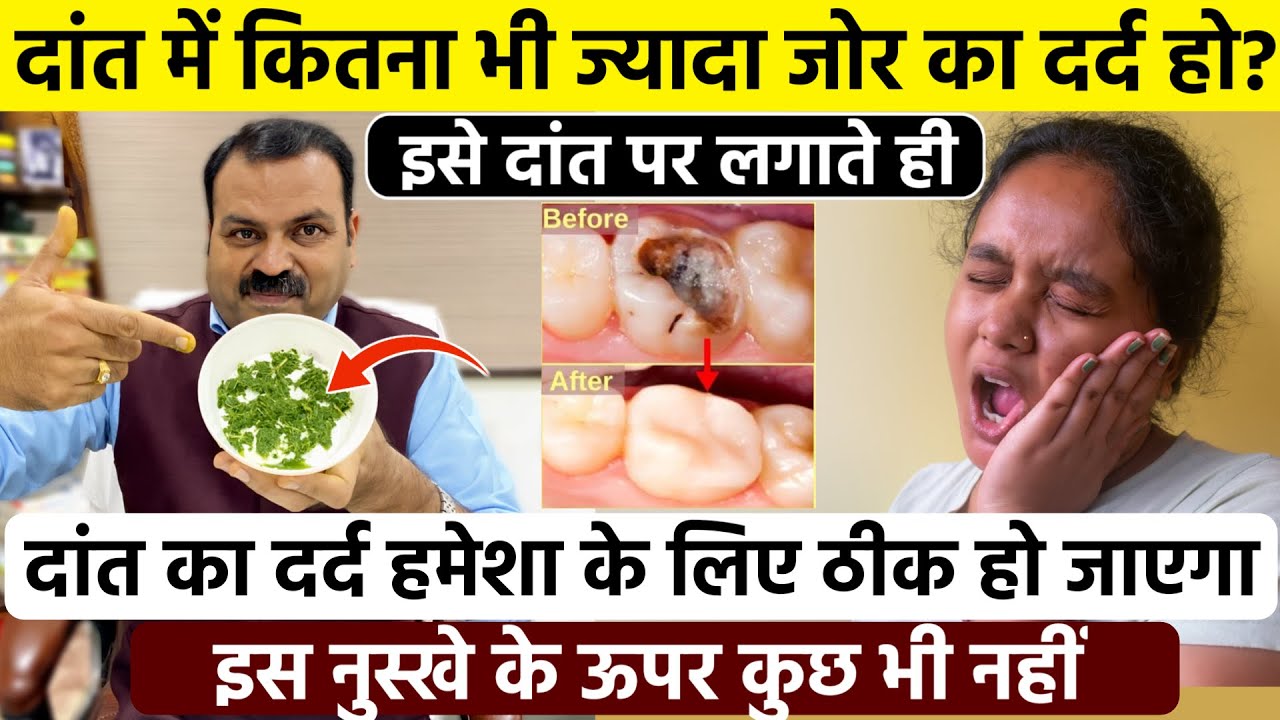 दांत में जोर का दर्द होगा तुरंत बंद, दांत में कीड़े, मसूड़ों से खून आना, सबसे का असरदार एक घरेलू इलाज