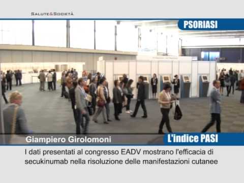 Cura di psoriasi sapone economico Eczema che sta tra le dita