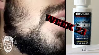 Minoxidil Beard | Week 23 | The Experiment | #Facialfuzzfridays