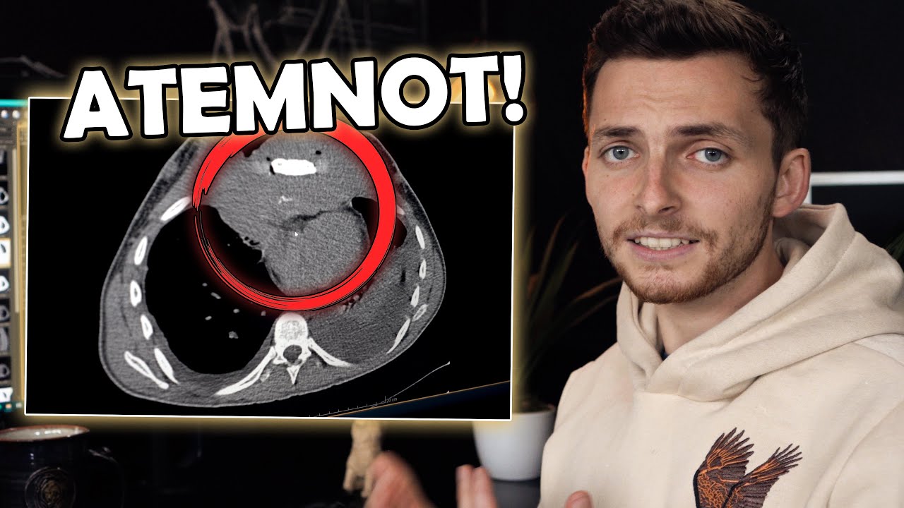 Warum ich Atemnot bekomme | Ich war beim Arzt