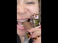 Twix Candy Bar Vs Braces