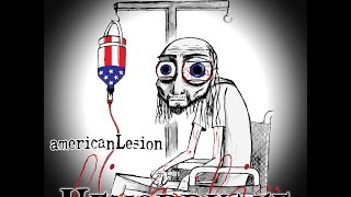 American Lesion - Hemorrhage