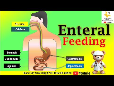 Enteral Feeding | Enteral Tube Feeding | ROUTES | NGT , NDT , NJT , OGT | Gastrostomy | Jejunostomy