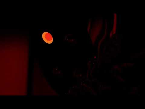 Win and Woo x Bryce Fox - Chicago (Inzo_Remix)