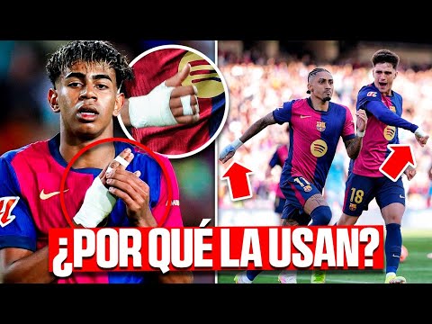 The REAL REASON why Barça's CRACKS wear BANDAGES on their hands. What trick are they hiding?👀😱