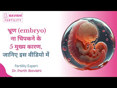 5 Reasons Embryo Implantation Fails