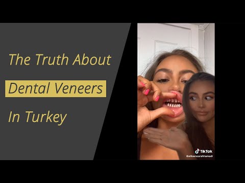 The Truth about Dental Veneers in Turkey