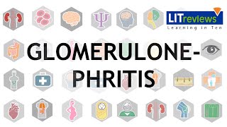 Glomerulonephritis