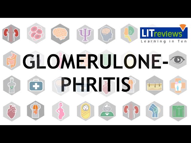 Video Pronunciation of glomerulonephritis in English Video Pronunciation of glomerulonephritis in English