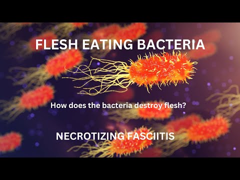 FLESH EATING BACTERIA! Necrotizing Fasciitis EXPLAINED! TOXINS! Do the BACTERIA EAT FLESH?