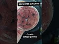 Opositiv Collagen Gummies Review Save Money With Coupons Collagengummies Skincare