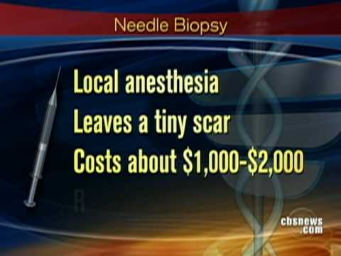 Unnecessary Surgeries?