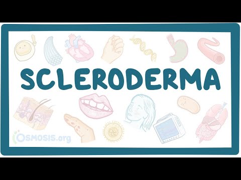 Scleroderma - an Osmosis Preview