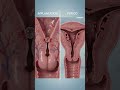 Implantation Bleeding vs Period: What’s the Difference? #pregnancy #medicalanimation