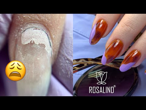 How to Fix Product Lifting | Tortoise Shell Nail Art with Rosalind Gel Polishes | Amazon Gel Kit