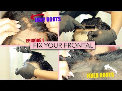 FIX YOUR FRONTAL SERIES: I over bleached  my Lace Frontal knots  | SaviHairCollection