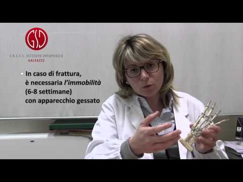 Expert's Answer – Orthopedics: Fracture of the Scaphoid of the Wrist