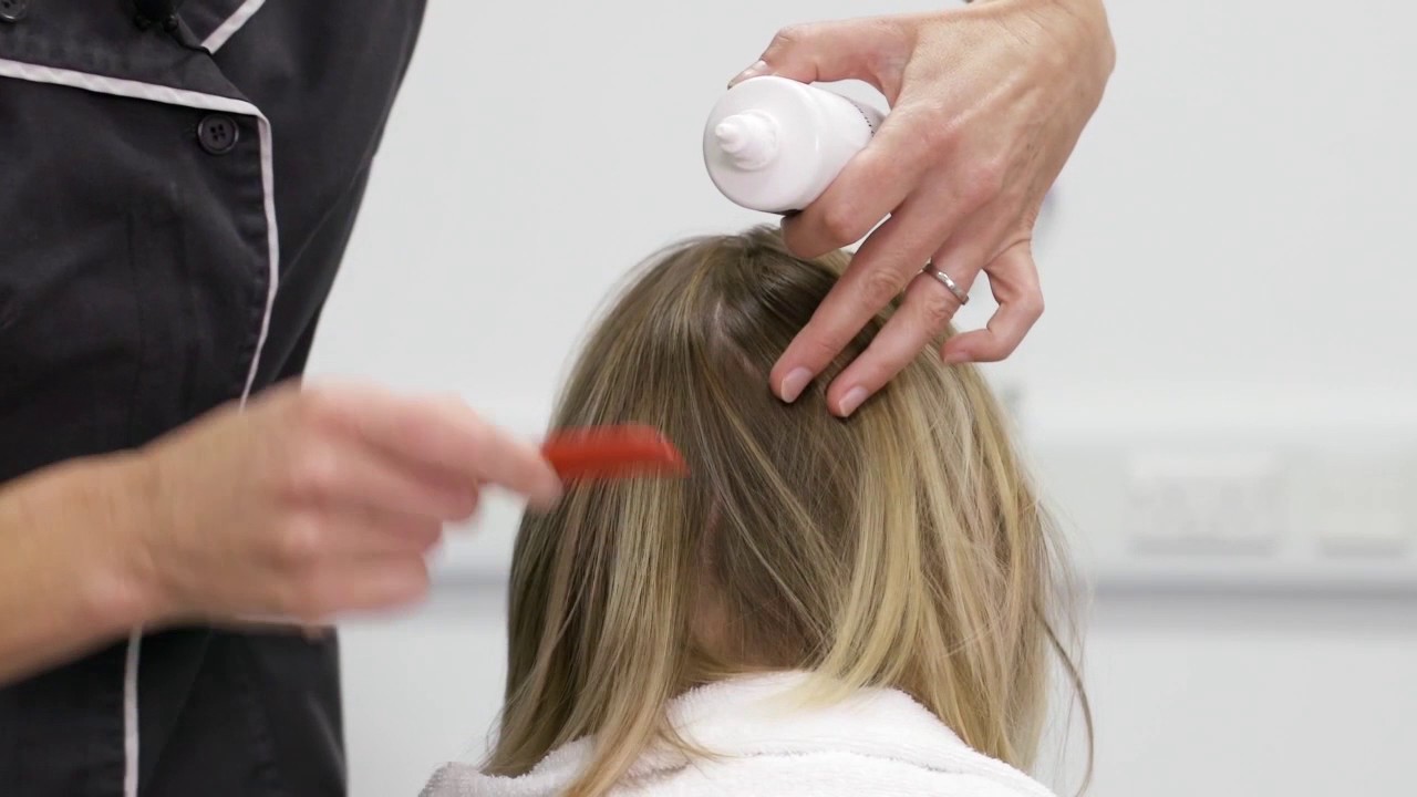 Treating scalp psoriasis - YouTube