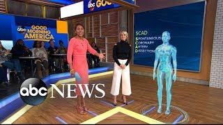 What to know about SCAD, a leading cause of heart attacks for young women