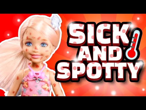 バービー - 病気と斑点 (Barbie - Sick and Spotty)