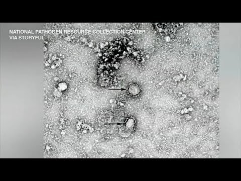 冠狀病毒。印第安納州波特縣可能有病人。 (Coronavirus: Possible patient in Porter County, Indiana)