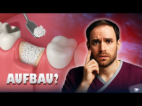 Zahnimplantat mit oder ohne Knochenaufbau – Was ist besser?