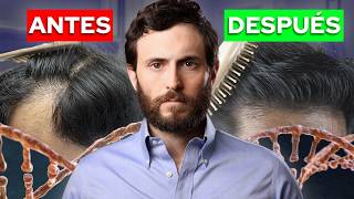 Por qué Perdemos Pelo y Cómo Frenarlo