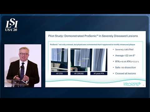Finbar Dolan, VERSONO Medical - Ultrasonic guidewire for crossing peripheral CTOs | LSI USA '26
