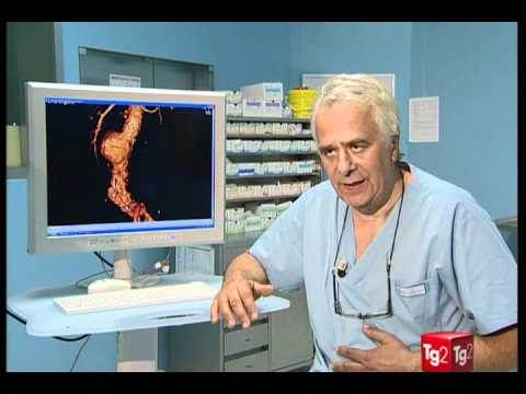 Trattamento osteocondrosi di riso. Fitoterapia alla malattia comune