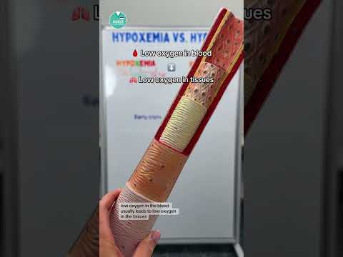 Hypoxemia vs. Hypoxia 🫁
