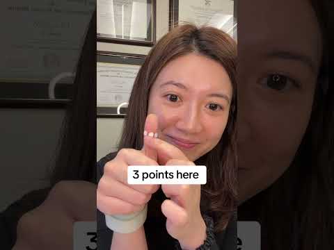 Get rid of your eye bags naturally with acupressure #acupuncture #acupressure #acupuncturist