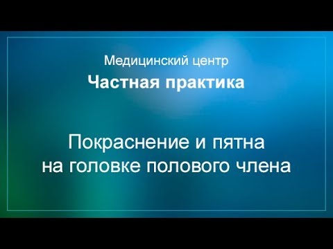 Эффективно отбеливает веснушки Какой крем помогает избавиться от пигментных пятен