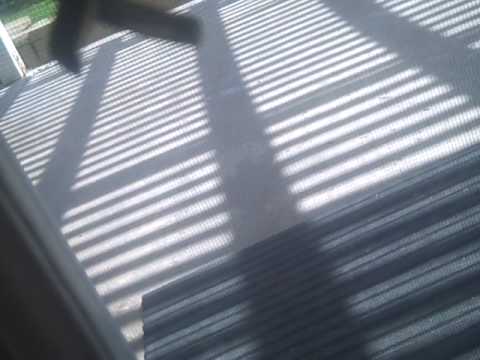 Bruise boy episode 2