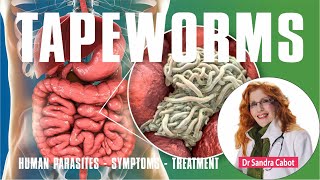 Tapeworms | Get Rid of Tapeworms, Roundworm | Causes, Symptoms, Effective Treatment #tapeworm