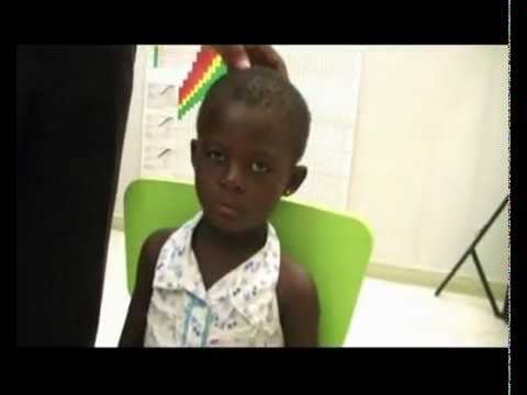 Paediatrics : Clinical Examinations - CNS Examination of Smell and Sight