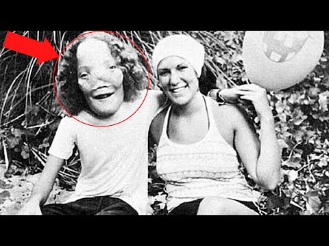 Rocky Dennis The true story of the boy who inspired ‘Mask’