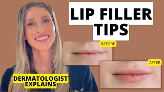 Dermatologist Shares 9 Lip Filler Tips to Know Before and After Treatment