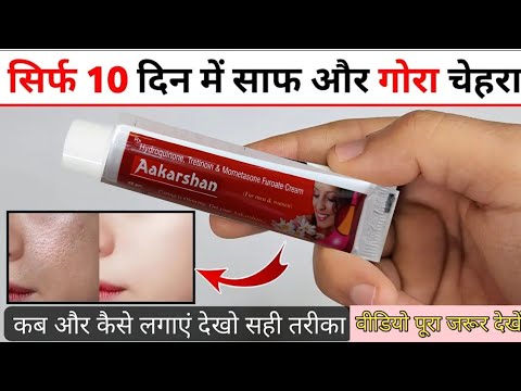 Aakarshan Cream uses | hydroquinone, tretinoin & mometasone furoste cream | चेहरे के दाग,धब्बे हटाएं
