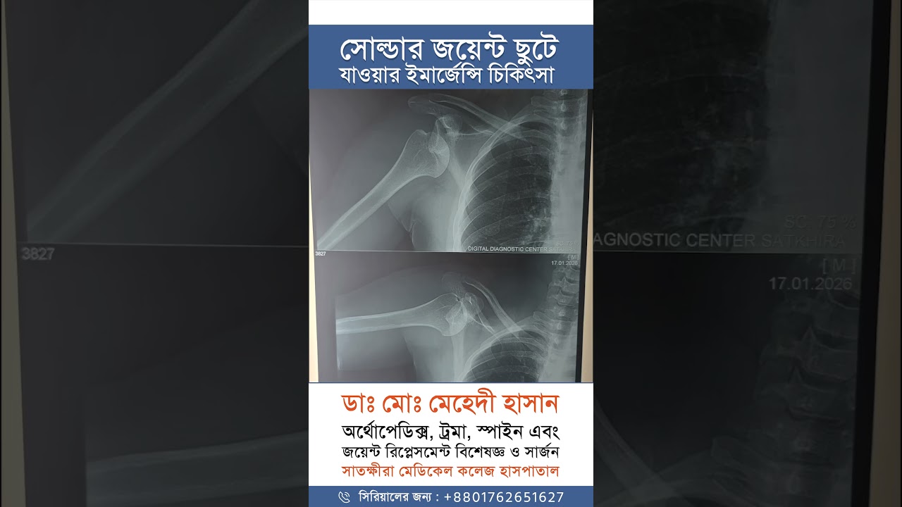 হাড় ও জয়েন্টের সমস্যা
